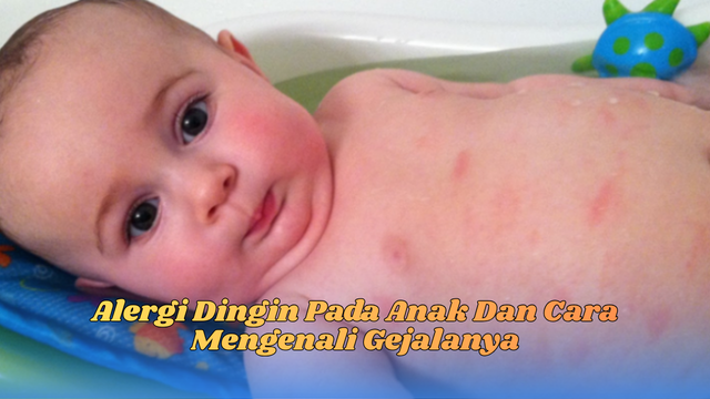 Alergi Dingin Pada Anak