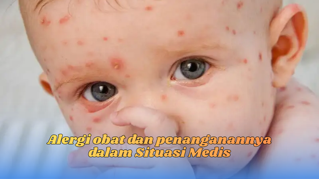 Alergi Obat Dan Penanganannya