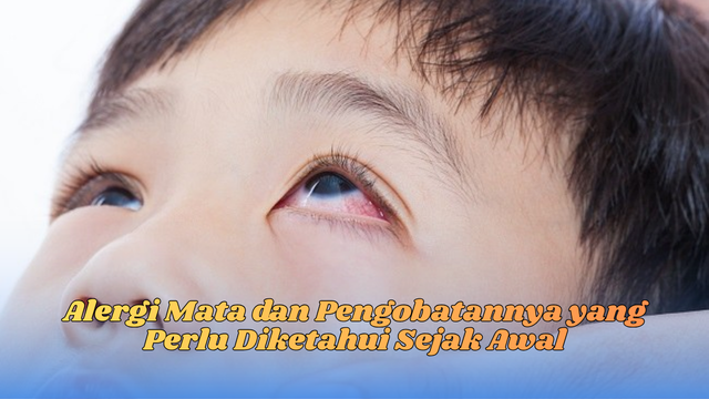 Alergi Mata dan Pengobatannya