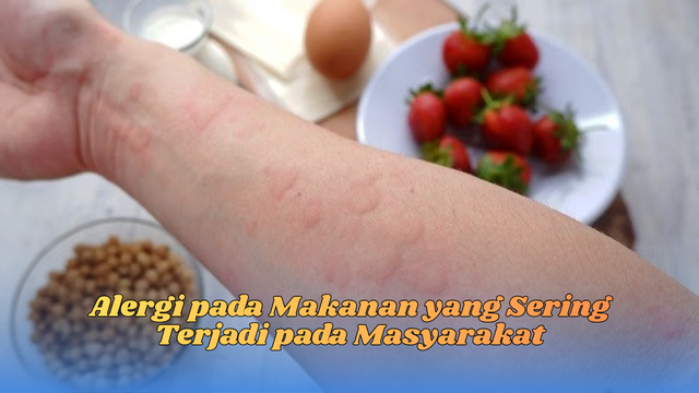 Alergi pada Makanan