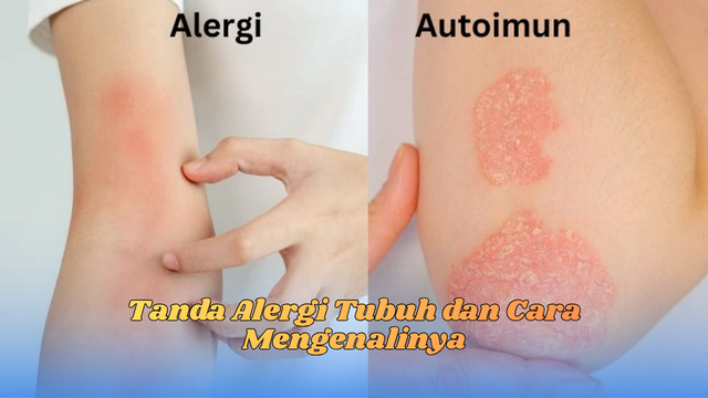 tanda alergi tubuh