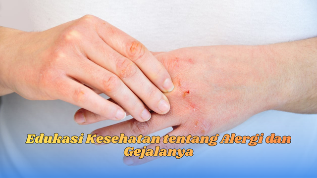 Edukasi Kesehatan tentang Alergi