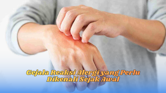 gejala reaksi alergi