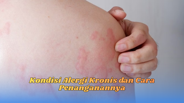 kondisi alergi kronis