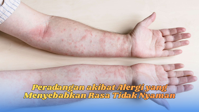 peradangan akibat alergi