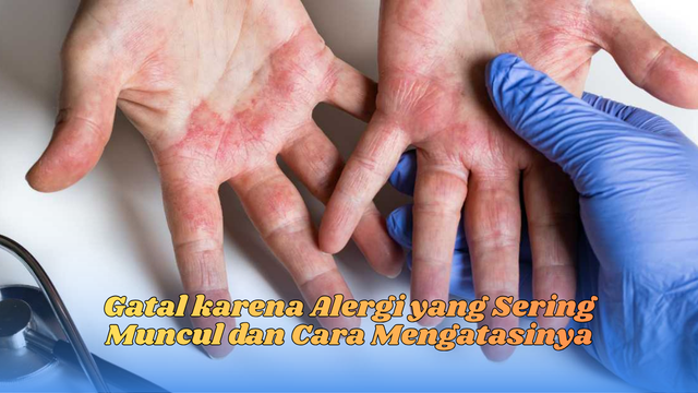 gatal karena alergi