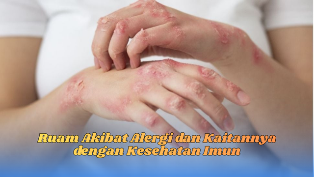 ruam akibat alergi