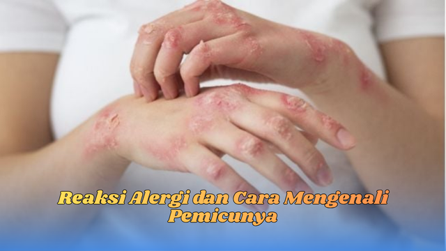 reaksi alergi