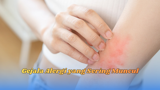 gejala alergi