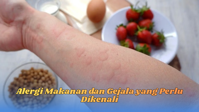 Alergi Makanan dan Gejala yang Perlu Dikenali