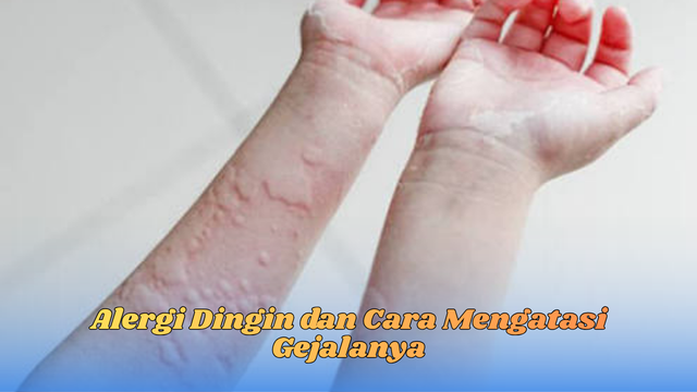 alergi dingin